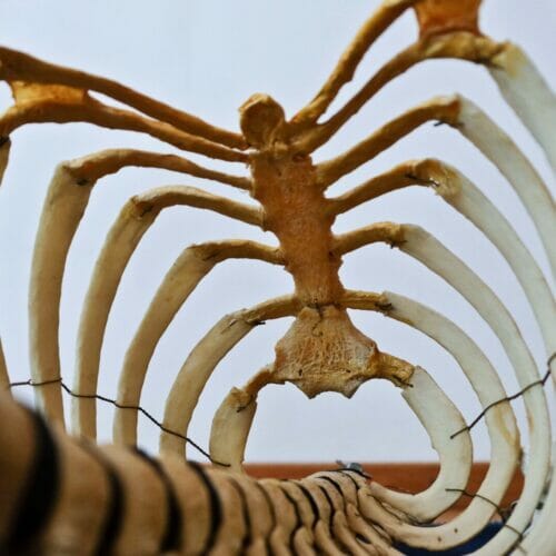 To understand the severities, it’s crucial to know the difference between spinal injury and spinal cord injury. Click to read more.